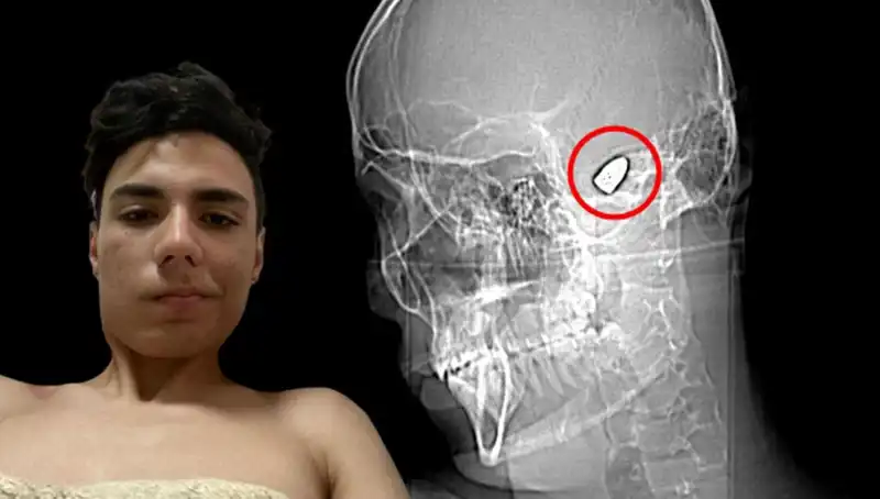 Kafasında Patlamaya Hazır Bir Bomba Taşıyan Adamın Hikayesi