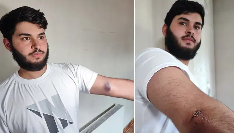 Bahçeye Kaçan Top, Mahalleyi Sarsan Olayı Başlattı: "Conolar Kamyonetle Geldi"